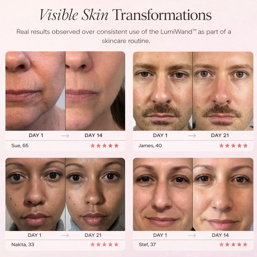 LumiWand™ 4-in-1 skincare wand