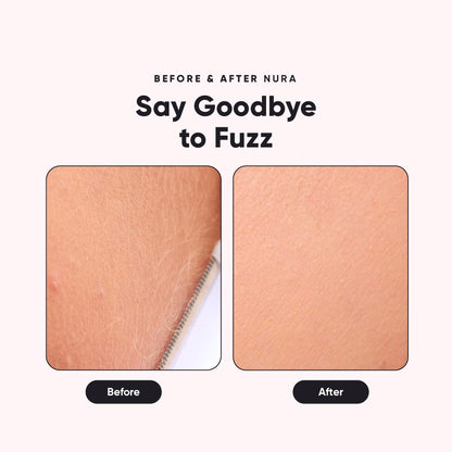 Nura™ - Sonic Dermaplaner