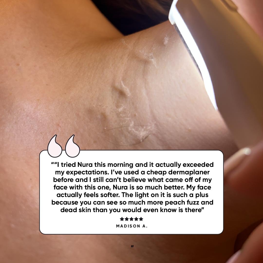 Nura™ - Sonic Dermaplaner