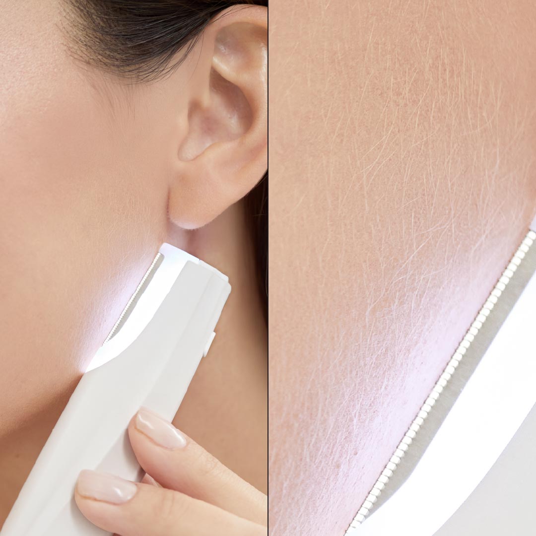 Nura™ - Sonic Dermaplaner