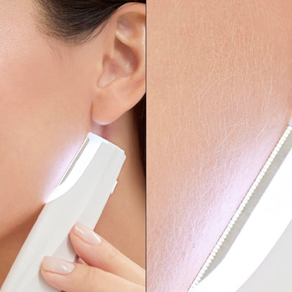 Nura™ - Sonic Dermaplaner