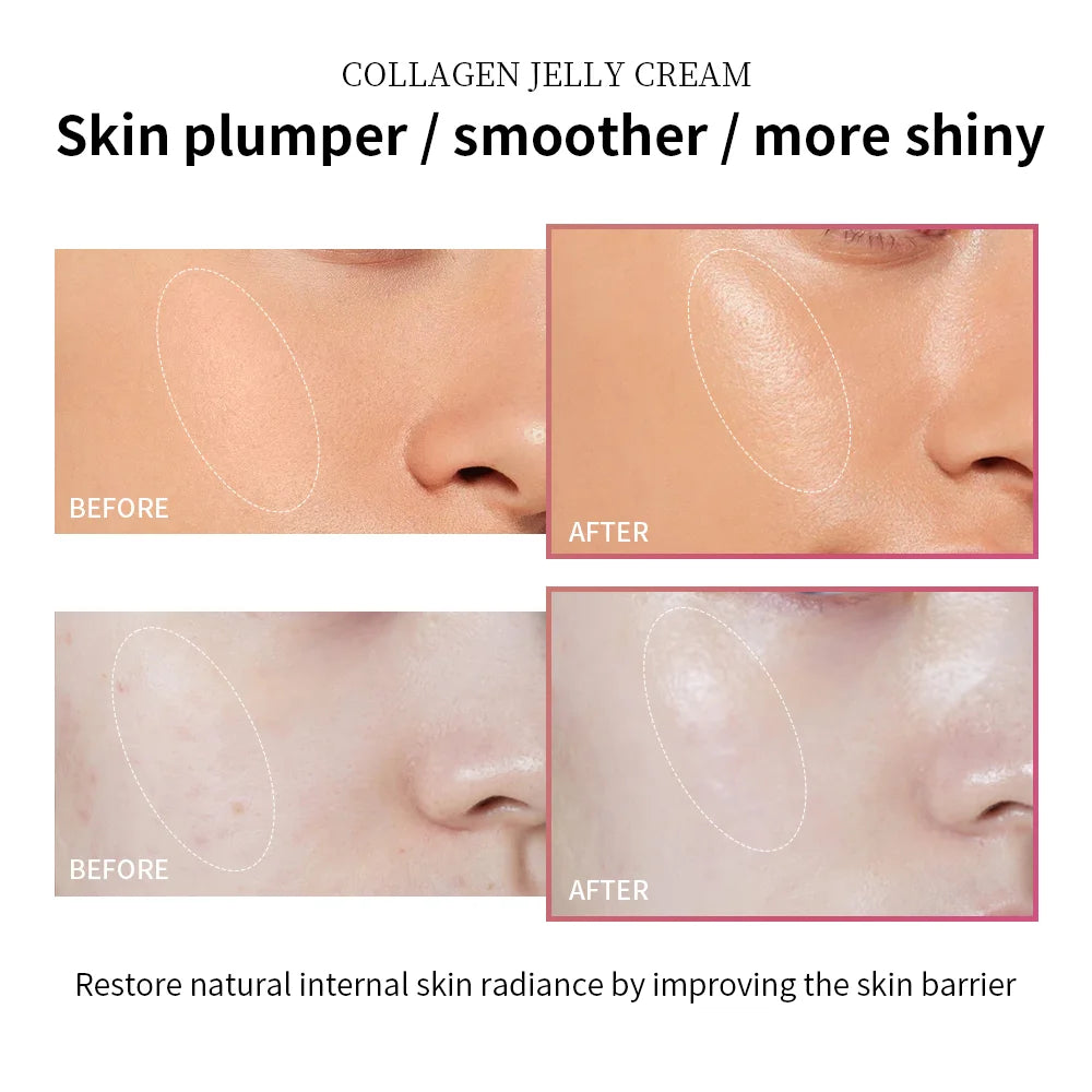 Aura™ – Collagen Jelly Cream